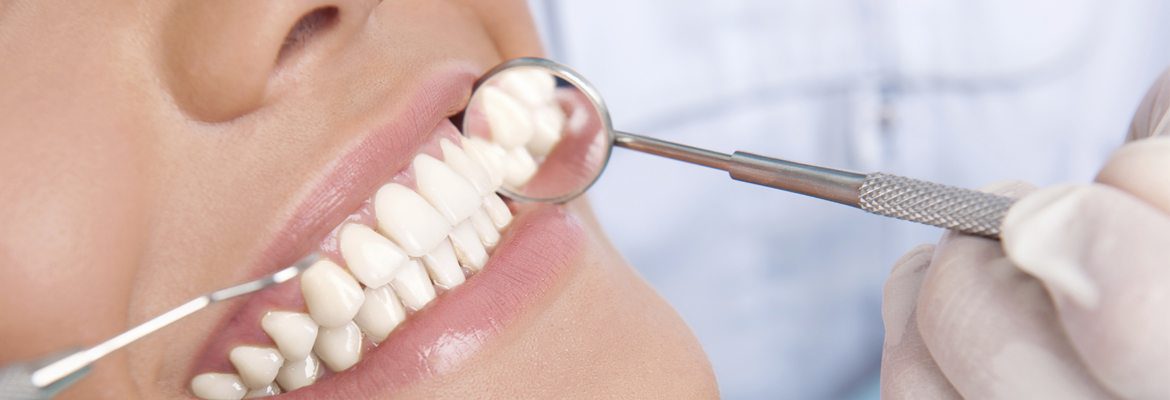 Prevention dentaire