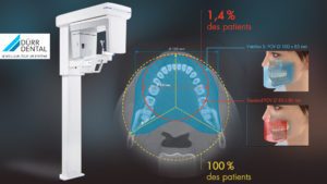 INNOVATION : VistaVox S Dürr Dental, le nouveau cone beam avec un champ de visualisation anatomique couvrant 100% de la zone dentaire