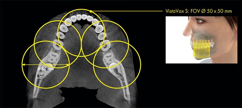 Cone Beam VistaVox S Dürr Dental avis