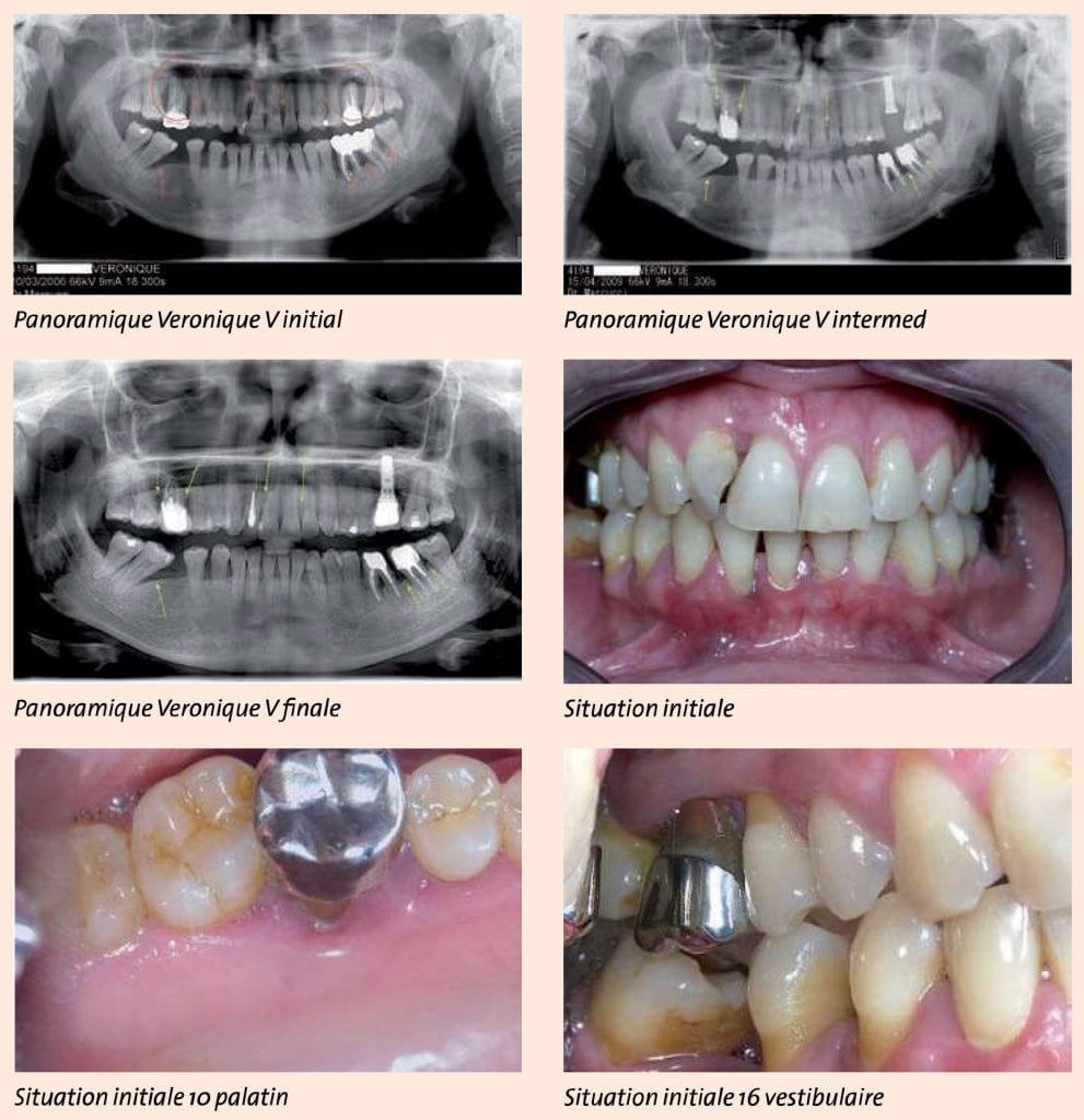 Cas clinique Vector Paro Dürr Dental