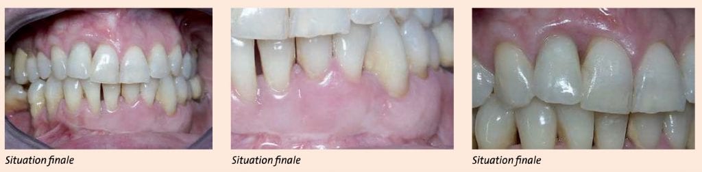 Cas clinique Vector Paro Dürr Dental