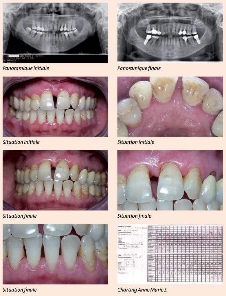 Cas clinique Vector Paro Dürr Dental