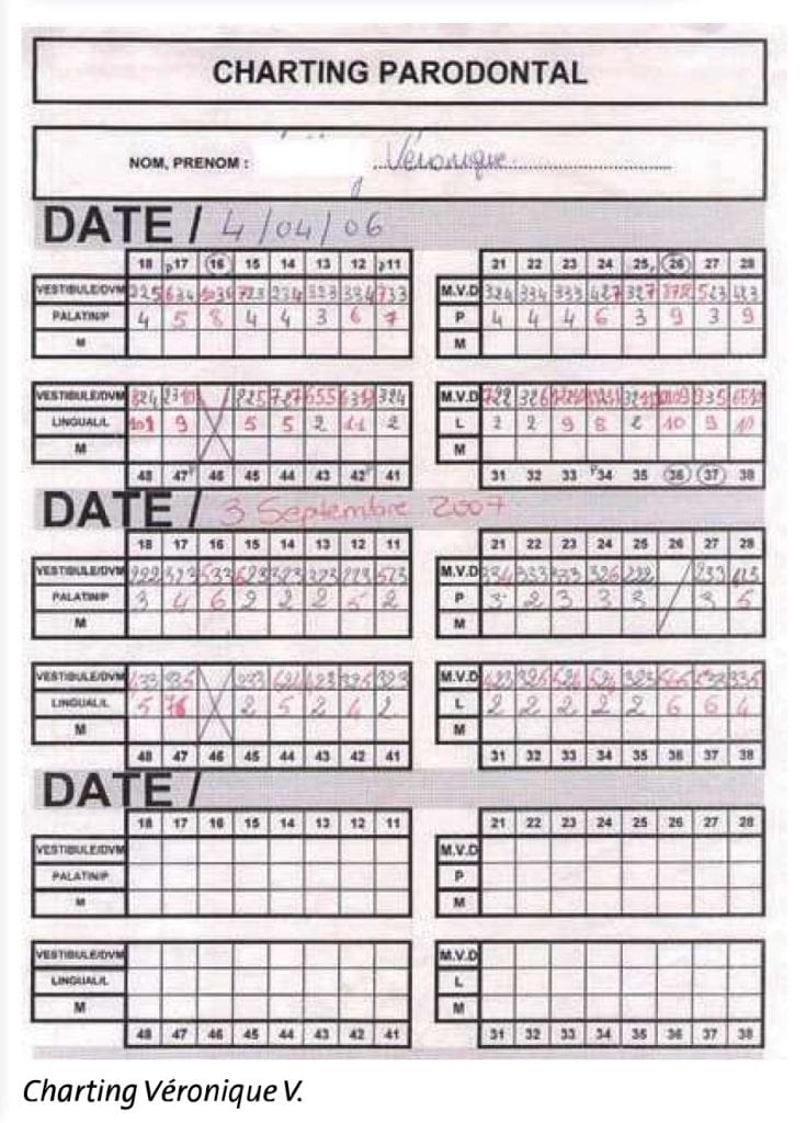 Charting parodontal