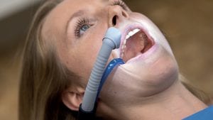Covid-19 : Dürr Dental présente deux innovations pour réduire efficacement les aérosols contaminés