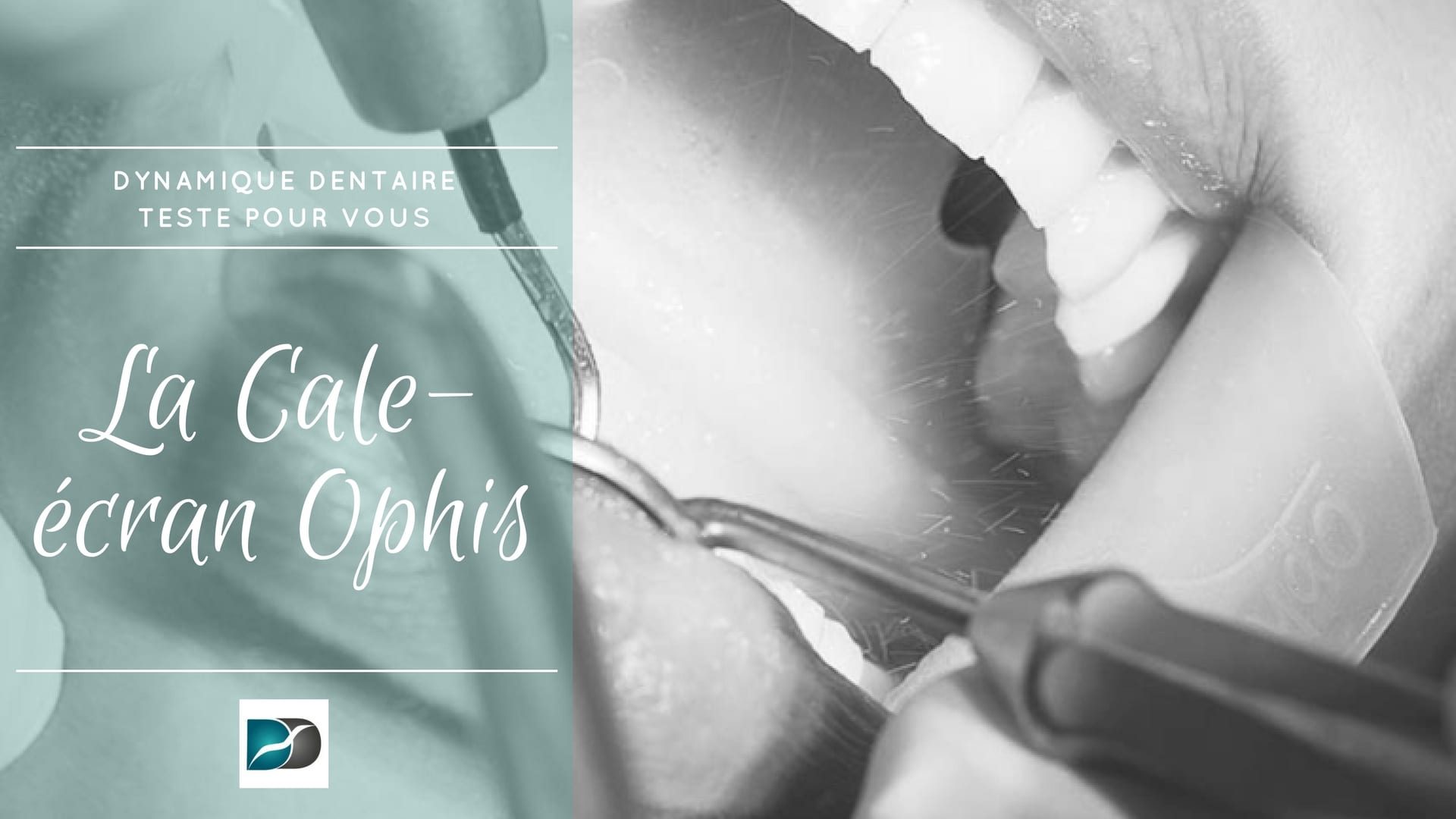 Cale -Ecran-ophis-avis-Dynamique-dentaire