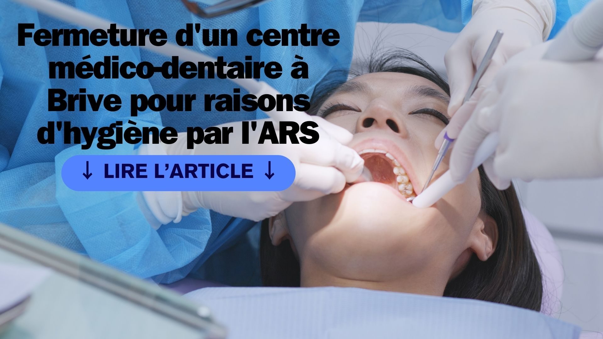 Fermeture d'un centre médico-dentaire à Brive pour raisons d'hygiène par l'ARS
