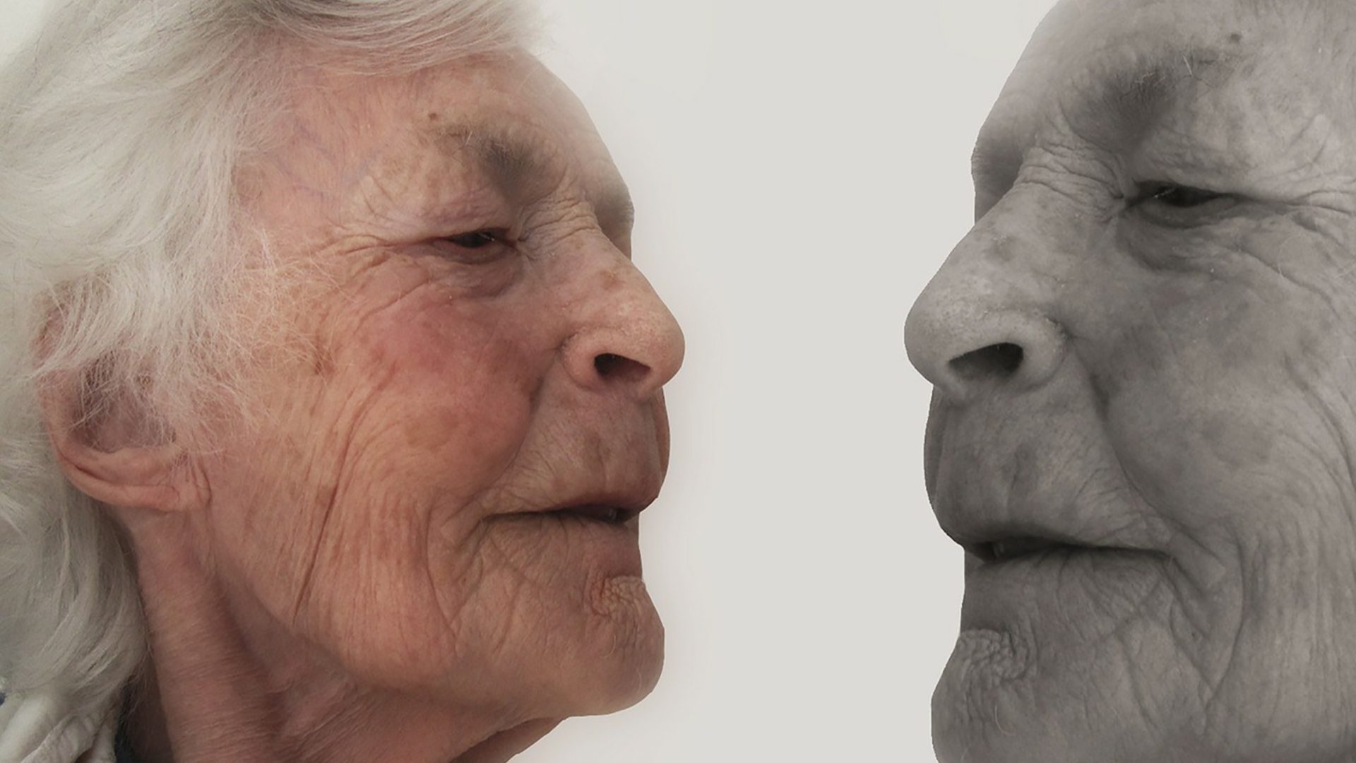 perte-des-dents-demence