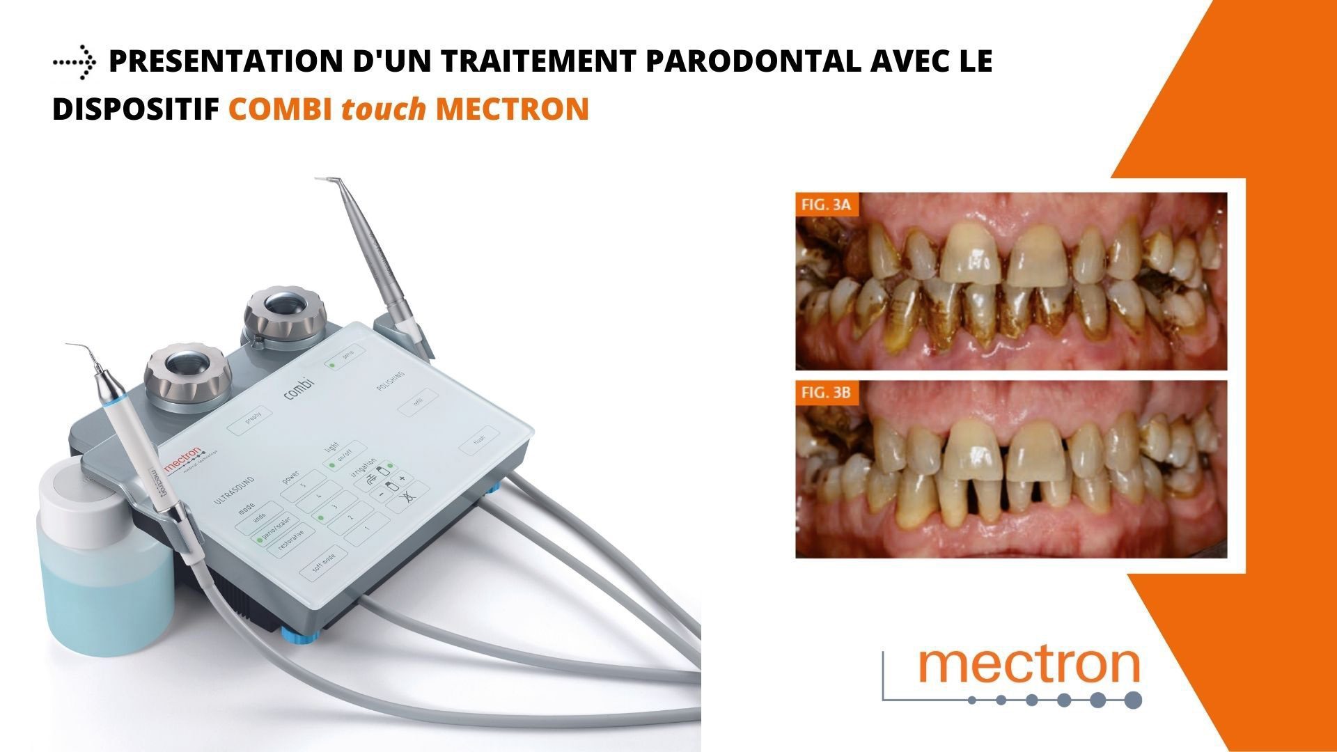 COMBI touch - la prophylaxie paro implantaire en un seul apparei